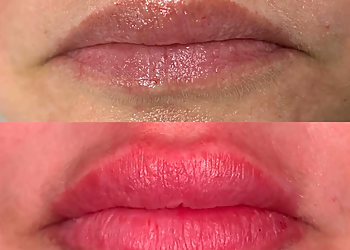 Grand Prairie Med Spa Ella Med Spa