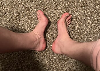 Fort Collins Podiatrists Emily Webb, DPM - DR WEBB FOOT & ANKLE CLINIC