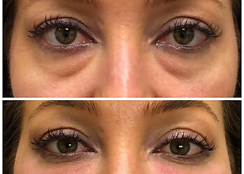 Arlington Med Spa Euro Image Med Spa