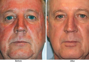 Milwaukee Med Spa EvolvMD