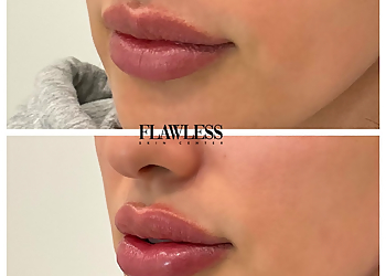 Burbank Med Spa Flawless Skin Center