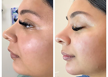 Burbank Med Spa Flawless Skin Center