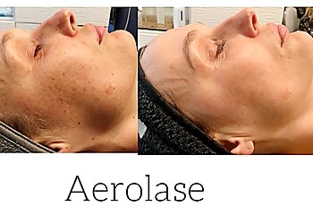 Portland Med Spa Fresh Faces Rx