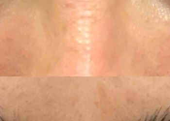 Thornton Med Spa Get Your Beauty On