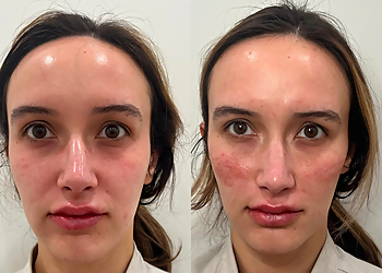 Mobile Med Spa Greater Mobile Laser & Aesthetic Center