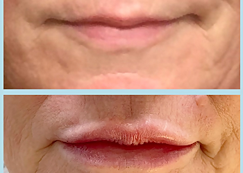 Greensboro Med Spa Infinite Allure