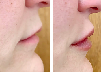 Greensboro Med Spa Infinite Allure