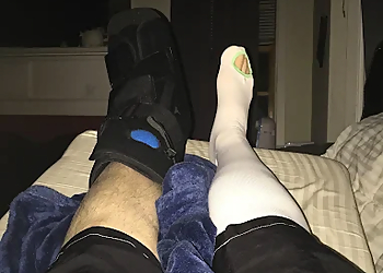 Joshua Van Gompel, DPM - Fremont, CA Podiatrists - Treatment Image