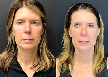 Cincinnati Med Spa Juvly Aesthetics