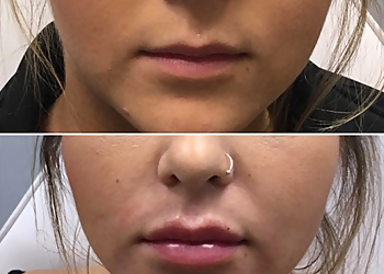 Cincinnati Med Spa Juvly Aesthetics