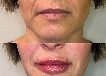 Allentown Med Spa KYRASKIN Aesthetics & Acne Specialists