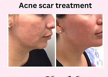 Fresno Med Spa Kiss Me Med Spa