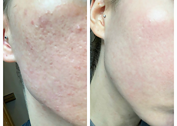 Seattle Med Spa Kucumber Skin Lounge LLC