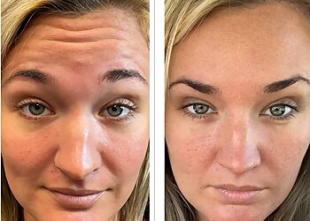 Montgomery Med Spa La Medspa