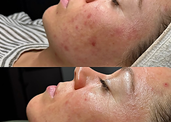 Fresno Spas La Peau Spa