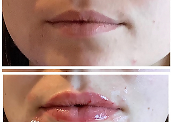 Boston Med Spa Laser MD Medspa