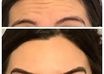 Boston Med Spa Laser MD Medspa