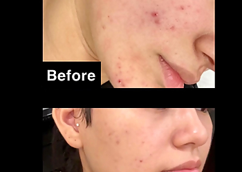 Laredo Med Spa Lazerit & Co.