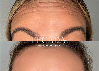 Tampa Med Spa Lecada Medical Artistry