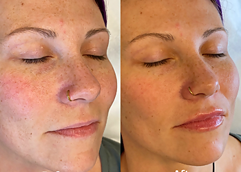 Orlando Med Spa LightTouch Med Spa