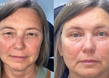 Greensboro Med Spa Luxe Aesthetics