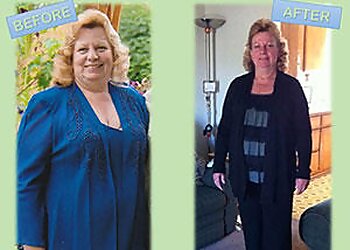 Anaheim Weight Loss Centers Medical Weight Control