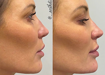 Allentown Med Spa Meesha Aesthetics