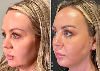 St Louis Med Spa Metro Medspa