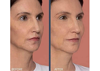 Michael J. Duffy, MD - Jacksonville, FL Plastic Surgeons - Healthcare Moments