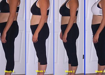 Milwaukee Weight Loss Centers Milwaukee Medical Weight Loss & MediSpa