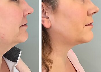 Minneapolis Med Spa Minneapolis Anti-Aging & Skin Clinic