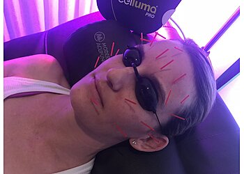 Scottsdale Acupuncture Modern Acupuncture