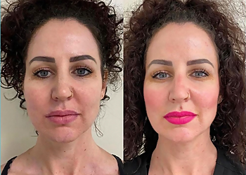 Modesto Med Spa Modesto Aesthetics & Laser