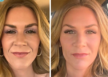 Modesto Med Spa Modesto Aesthetics & Laser