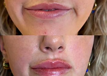 Buffalo Med Spa Monroe MedSpa