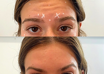 Rochester Med Spa Monroe MedSpa