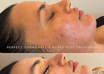 Riverside Med Spa NakedMD Med Spa Riverside