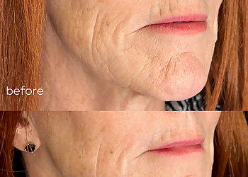 Nashville Med Spa Nashville Skin Company