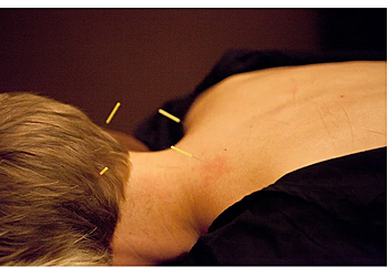 Sioux Falls Acupuncture Natural Arts Chiropractic & Acupuncture