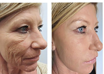 Pueblo Med Spa New Look Solutions