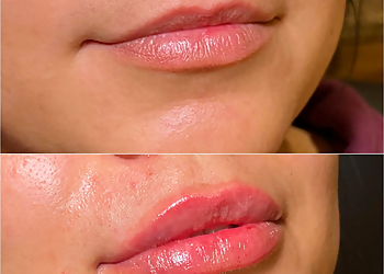 Midland Med Spa New-U Med Spa