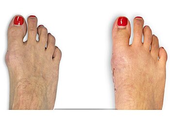 Akron Podiatrists Nicholas A. Campitelli, DPM, FACFAS