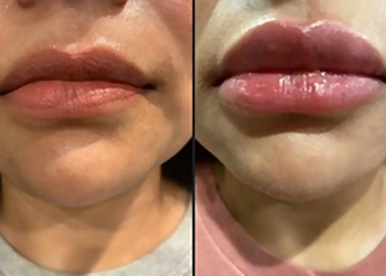 Little Rock Med Spa Nirvana Med Spa