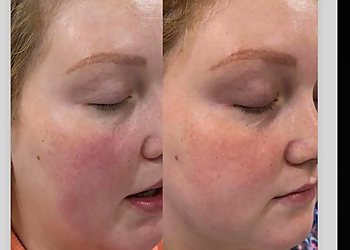 Chula Vista Med Spa One Medical Spa Inc.