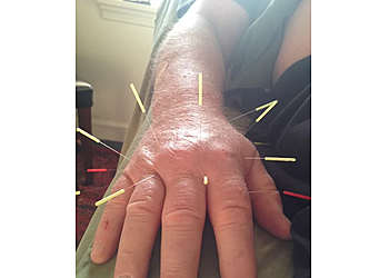 Winston Salem Acupuncture Piedmont Acupuncture & Oriental Medicine