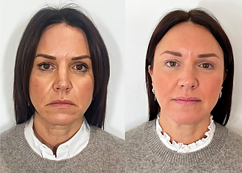 Santa Ana Med Spa Plump Medical Spa