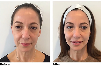 Santa Ana Med Spa Plump Medical Spa