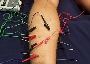 Charlotte Acupuncture Queen City Acupuncture and Wellness Center