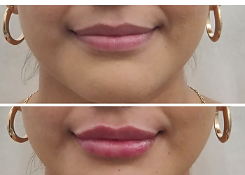 San Bernardino Med Spa Quintessential Care Health & Wellness