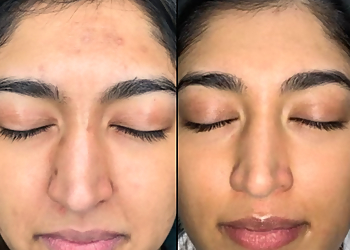 Madison Med Spa Radiance Skin Therapy & Laser Center